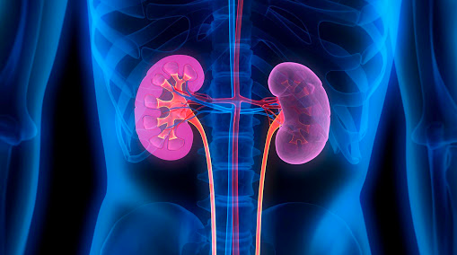 Renal angiomyolipoma